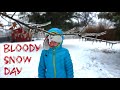 Bloody Snow Day