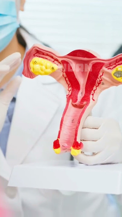 Miss V yang Sehat, ini cirinya! #missvgatal #shortsvideo #bidan #shorts