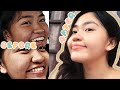 5-STEP MORNING SKIN CARE ROUTINE 2021🍃 | road to clear skin ft. Celeb Asia! (Philippines)