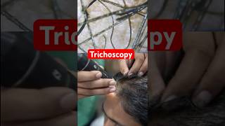 Trichoscopy at Reehairskin India #dermatology