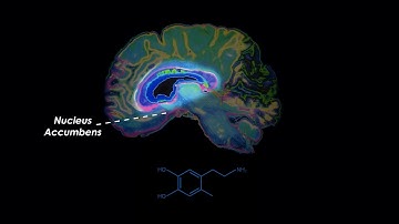 This Is How Opioids Impact Your Brain | Opioids in NY