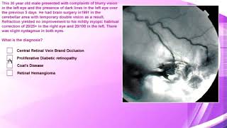 OPSM Lesson - Optometrist Training 2004-2009