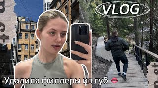 Удалила филлеры из губ | April vlog | Мои повседневные дни