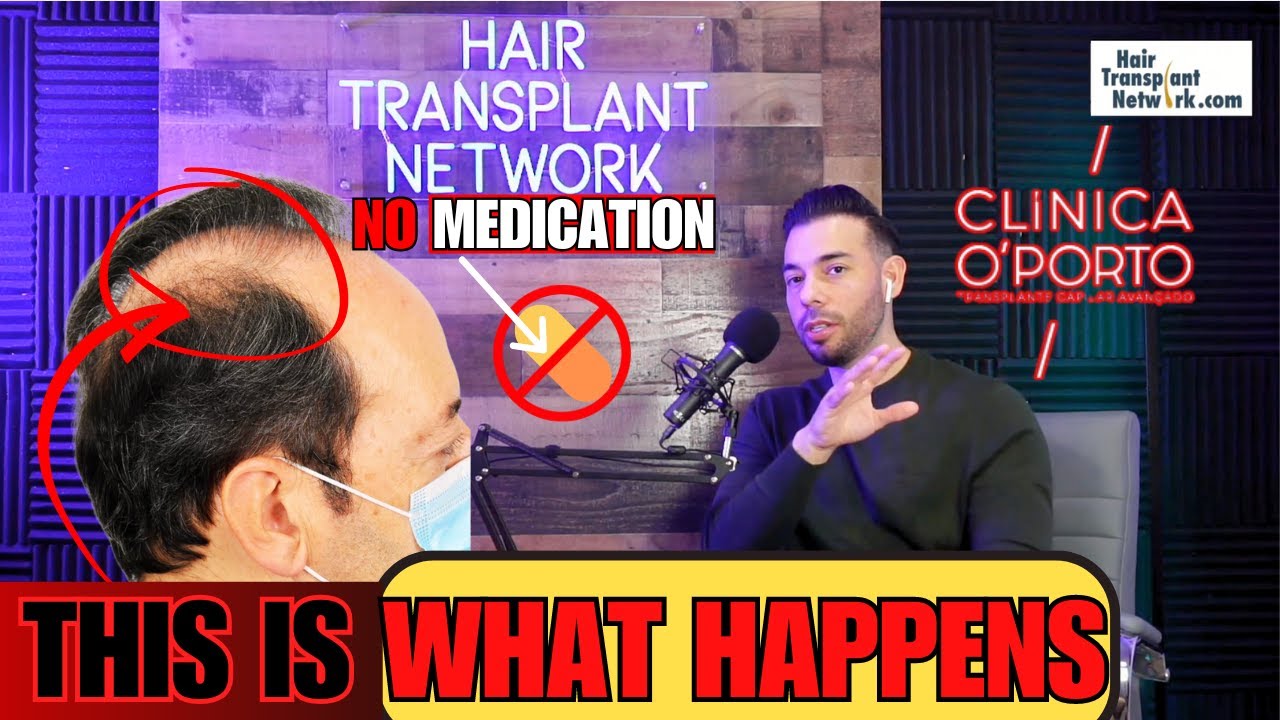 Hair Transplant Without Finasteride, Hairline Repairs, Avoid Hair Mills Dr. Bruno Pinto YouTube