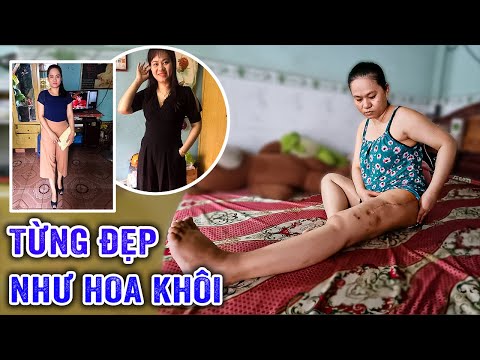 🔴 XE TẢI CÁN NGANG CHÂN, MẸ ĐƠN THÂN TỪNG ĐẸP NHƯ HOA KHÔI MAY MẮN …SỐNG SÓT, GIỜ …TÀN TẠ, BẾ TẮC