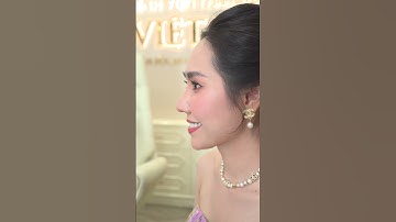 Hành trình sửa lại chiếc mũi bị co rút cho em gái 2k