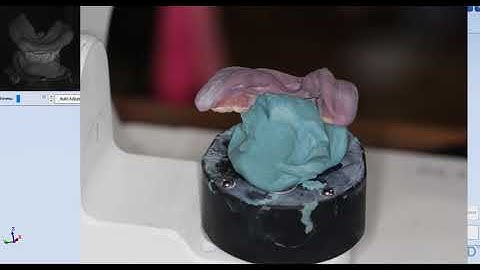 Scanning Articulated Bite Rims for Digital Dentures