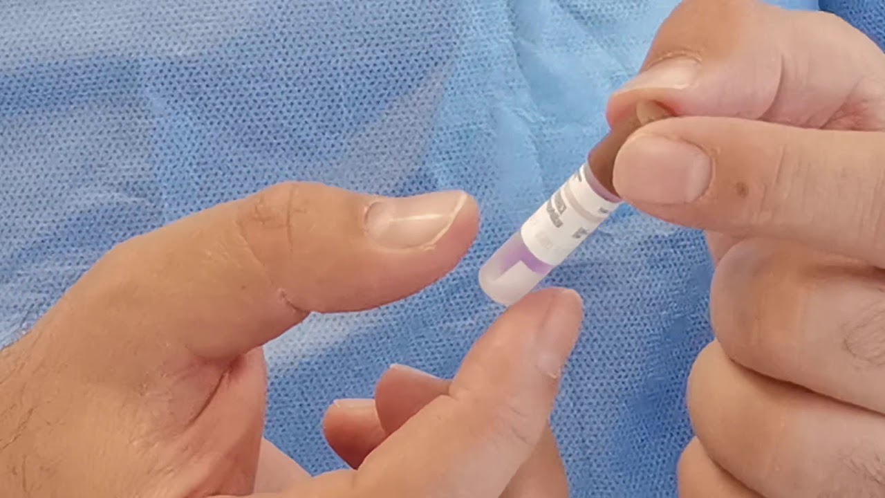 Sterilization Indicators video أنواع اختبارات ومؤشرات التعقيم