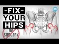 The ultimate guide to nonsurgical treatments for hip impingement femoroacetabular impingement