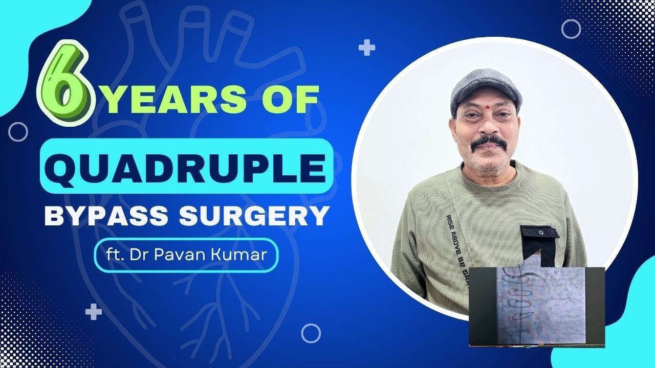 6 Years of Quadruple Bypass Surgery | Long-Term Results of CABG by Dr. Pavan Kumar