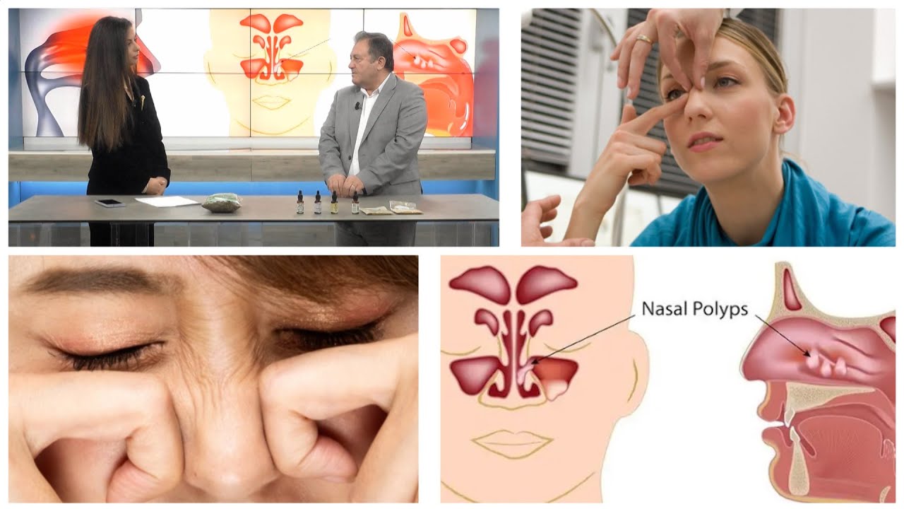 Ylli Merja: Ja si ta zhdukni pa bisturi me këto 'sekrete' natyrale mishin e huaj në hundë