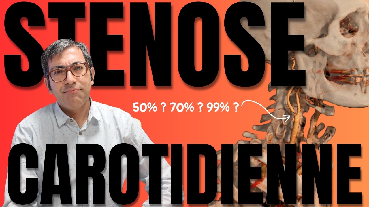 Sténose carotidienne : comment la confirmer et l'analyser avec l'angioscanner