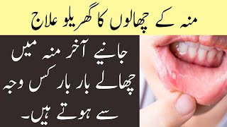 Munh Mein Bar Bar Chhale Kyon Hote Hain L Munh Ke Chhalon Ke Gharelu Totke Healthcare Tips