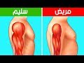 ضمور العضلات لا تتجاهل 8 علامات مبكرة