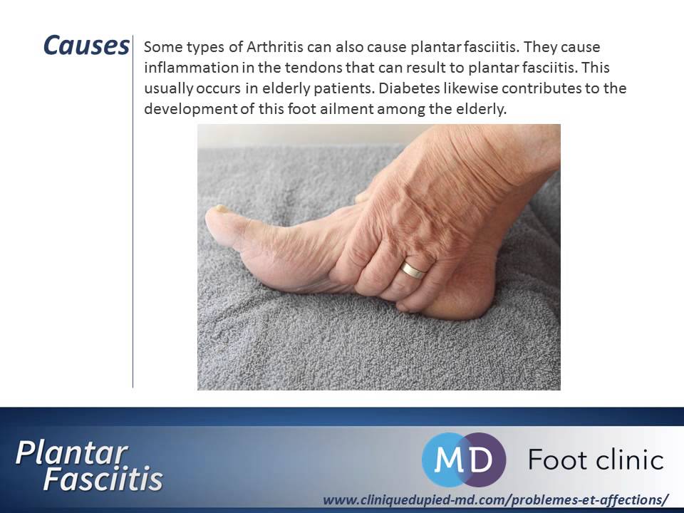 Plantar Fasciitis Origin, Causes, Examination, Treatment of plantar