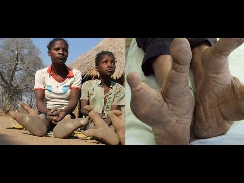 Βίντεο: Ποιες φυλές είναι γνωστές για τον κανιβαλισμό τους