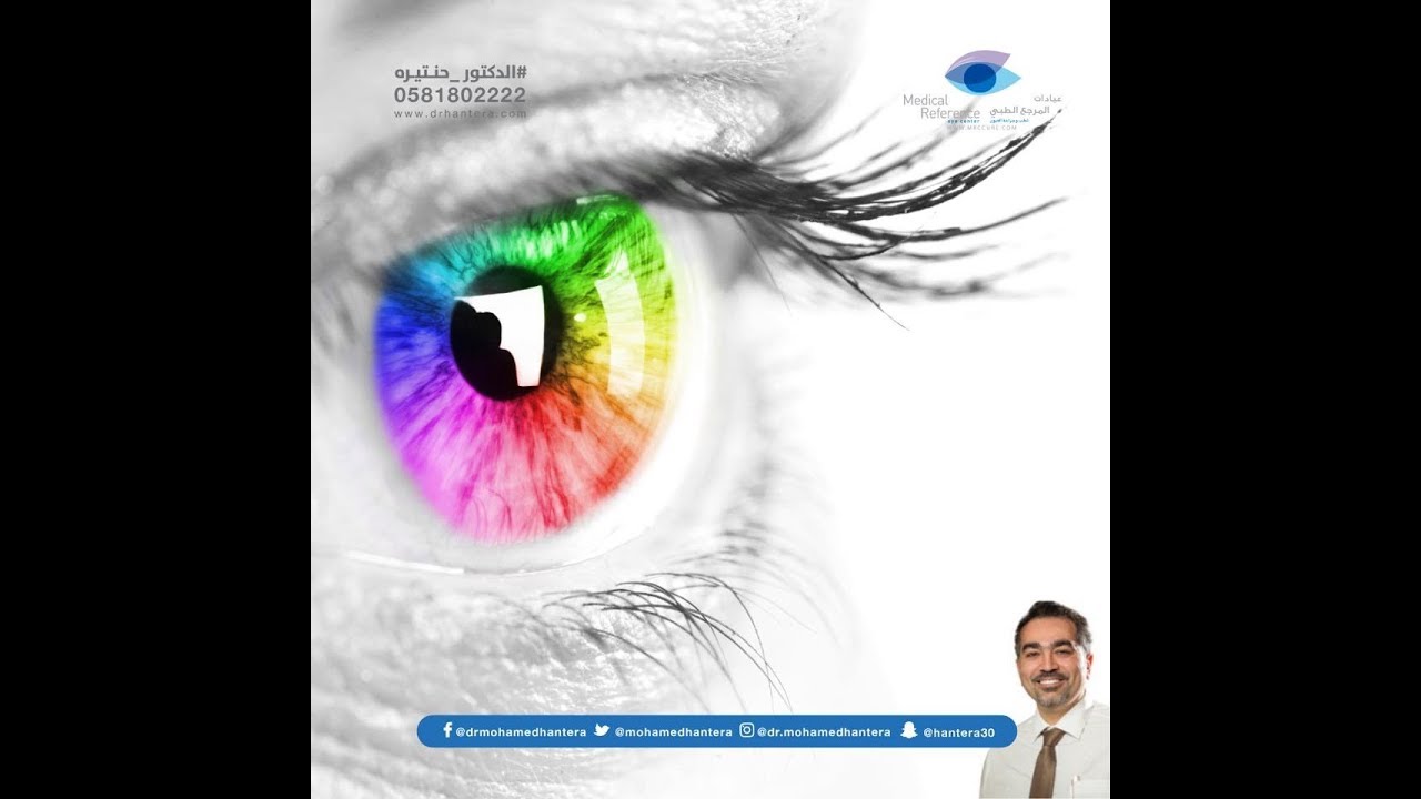 احدث تقنيات علاج الذبابة الطائرة في العين مع الدكتور حنتيرة