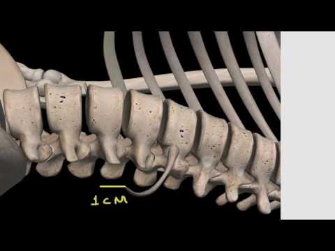 DECÚBITO LATERAL MODIFICADO CON FLUOROSCOPÍA FIJA SMU 2016