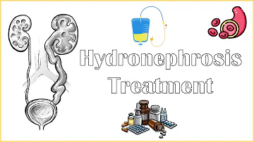 Hydronephrosis Treatment - Medical & Surgical Management Of Hydronephrosis