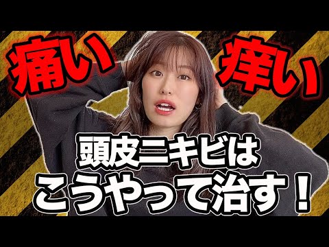 頭皮が痒い！痛い！突然できる頭皮ニキビの原因は〇〇！？表参道美容師が徹底解説！