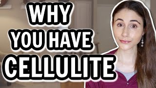 WHY YOU HAVE CELLULITE & HOW TO GET RID OF IT // Dermatologist @DrDrayzday screenshot 3