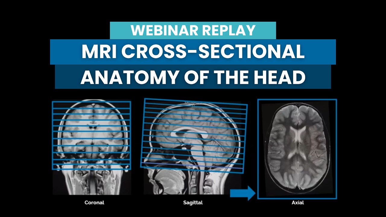 Mri Axial Cross Sectional Anatomy Of Brain Youtube