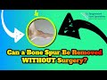 Can a Bone Spur on Feet Be Removed Without Surgery?