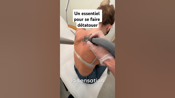 Un essentiel pour se faire détatouer #tatouage #laser #detatouage