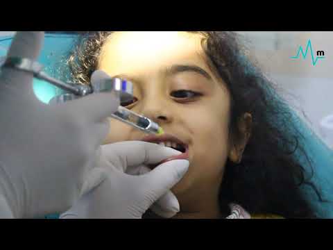 Video: Diş üçün diş