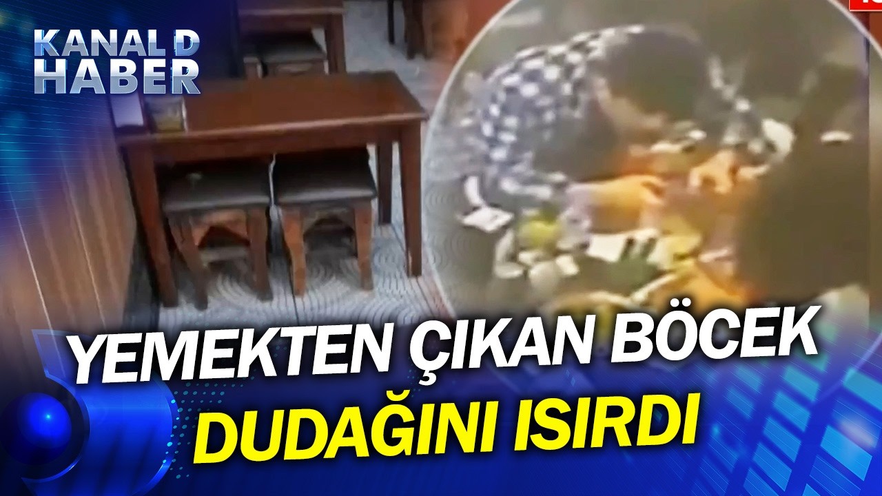 İstanbul'da Restoranda Yemeğin İçinden Çıkan Böcek Dudağını Isırdı! Yemek Yerken Kabusu Yaşadı