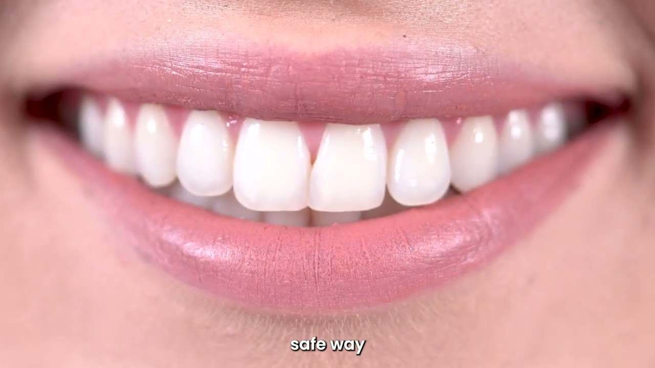 youtube-video-thumbnail