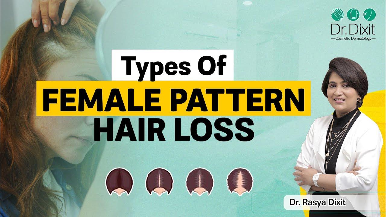 HAIR LOSS IN WOMEN FEMALE PATTERN HAIR LOSS TREATMENT DR RASYA DIXIT
