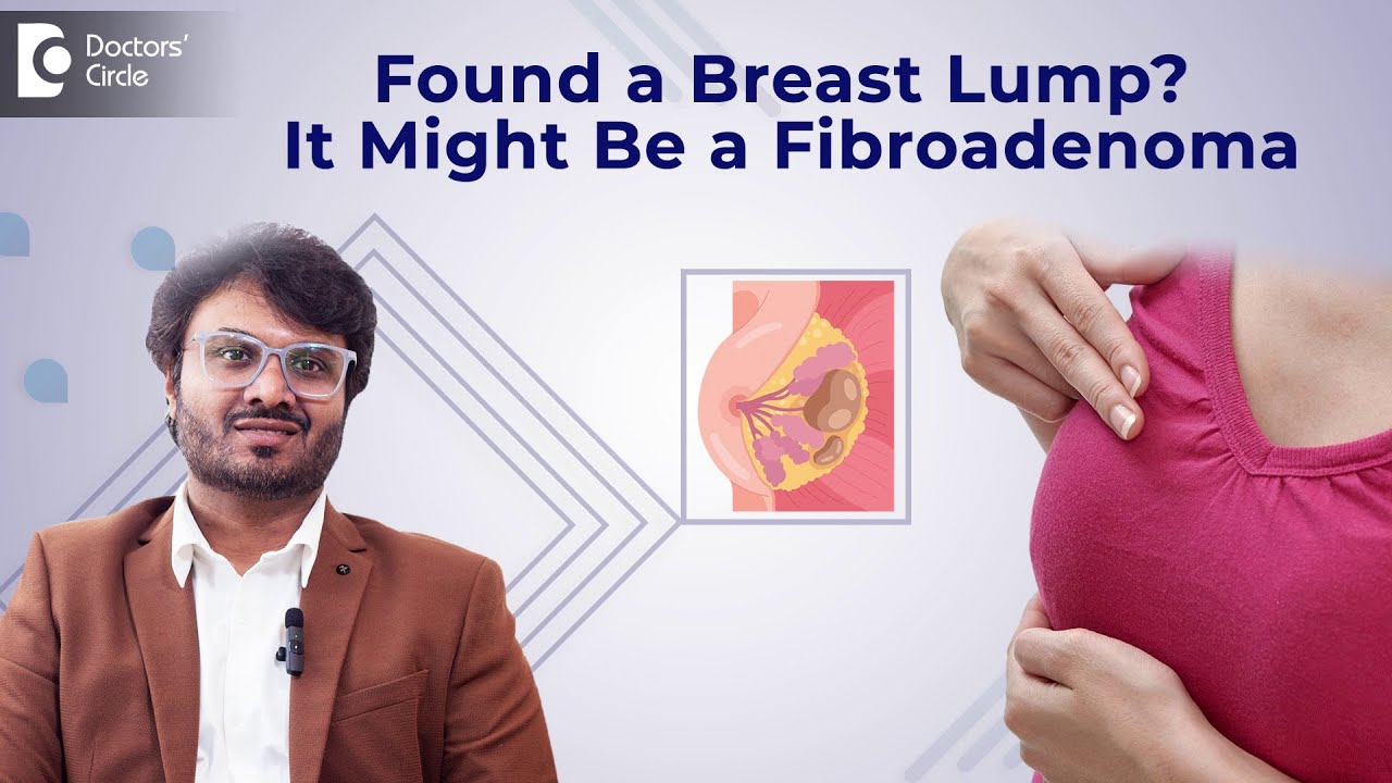 lump-in-breast-fibroadenoma-rubbery-mass-moves-under-skin-fnac