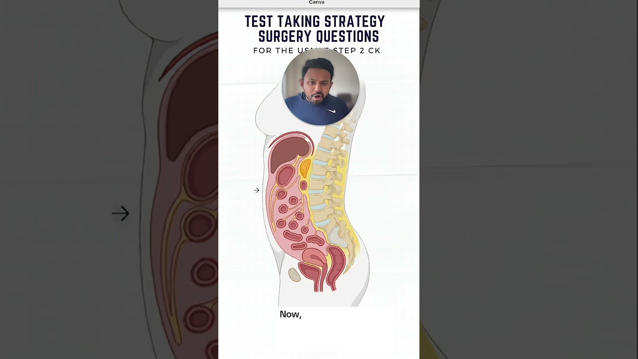 Surgical Abdomen for the USMLE | HyGuru