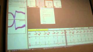 Labtech Holter1