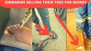 Zimbabwe people selling their Toes for Money $40000