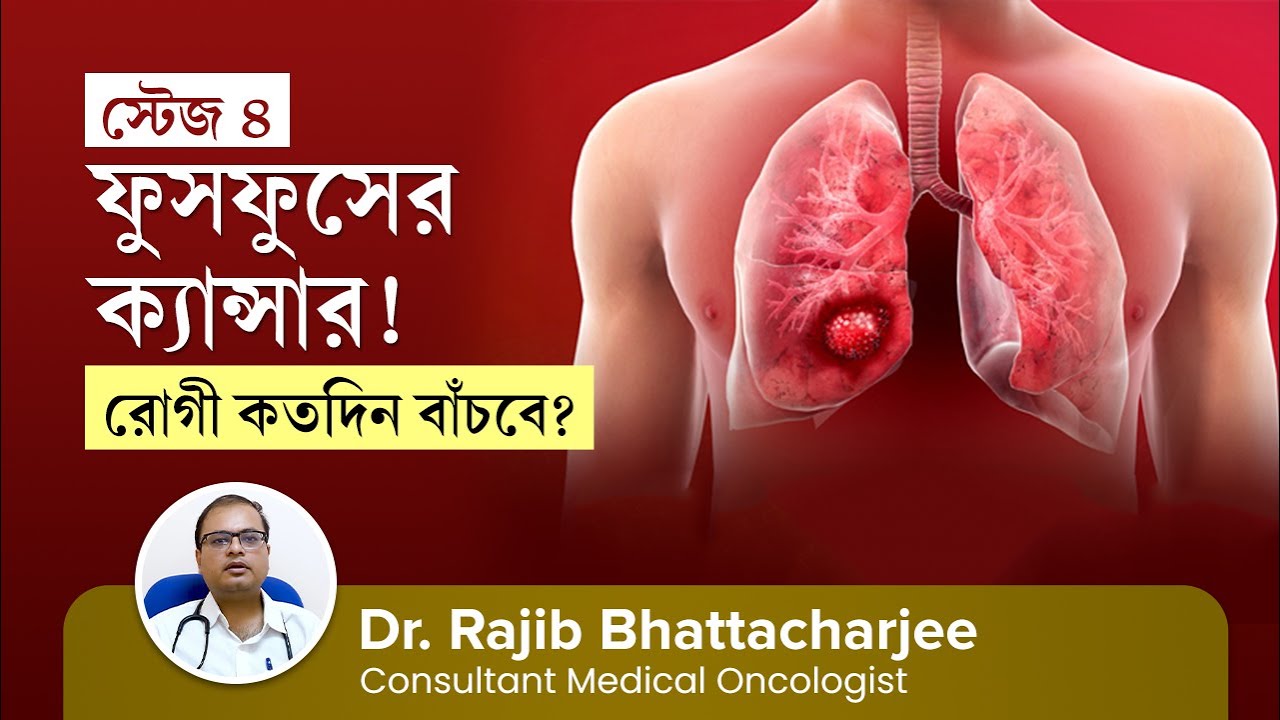 স্টেজ ৪ ফুসফুস ক্যান্সারের চিকিৎসা | রোগী কতদিন বাঁচবে | Stage 4 Lung Cancer Treatment