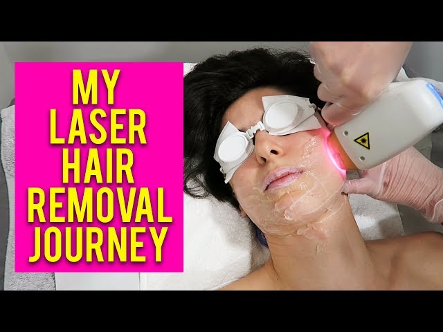 Laser Facial Hair Removal Treatment: Your Ultimate Guide!