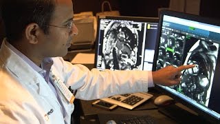 Cardiac MRI in Valvular Heart Disease