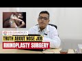 ENT Surgeon explains NOSE JOB aka RHINOPLASTY | Wellsun Medicity Hospital