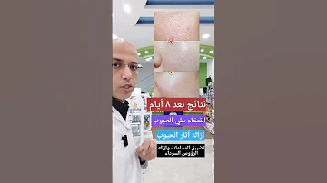 كريم فعلا خطير الحبوب البشره الدهنيه تفتيح البشرة العنايه بالبشرة Fyp Explore دكتور رامي 