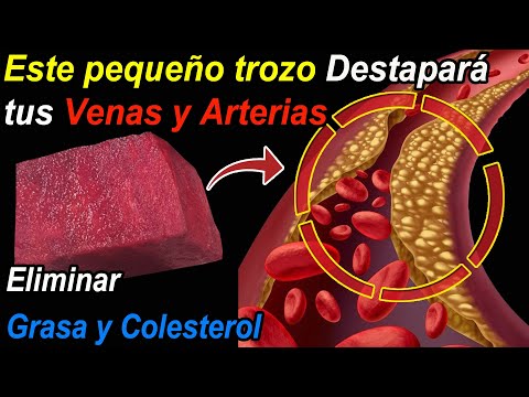 Este pequeño trozo Destapará tus Venas y Eliminará Grasa Corporal y Colesterol <strong>Malo</strong>