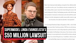 Supermodel Linda Evangelista Files $50 Million Lawsuit After Botched Cosmetic Treatment | Cobrapost