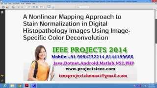 A Nonlinear Mapping Approach to Stain Normalization in Digital Histopathology Images Using Image Spe News
