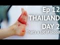 OUCH - Thailand day 2