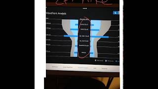 Optical Aberrations, a review for LensCrafters doctors