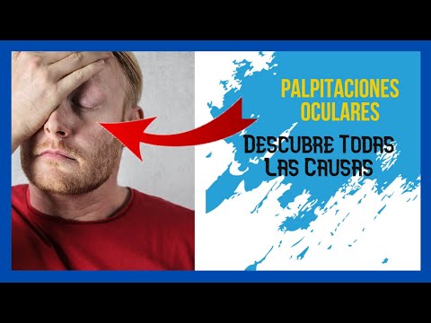 Latidos En El Ojo 【  Palpitaciones En El Ojo Descubre Todas Las Causas 】