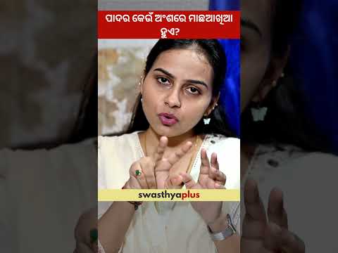 ପାଦର କେଉଁ ଅଂଶରେ ମାଛଆଖିଆ ହୁଏ? | Which parts of the foot are affected by Corns? | Dr Mrunmayee Behera