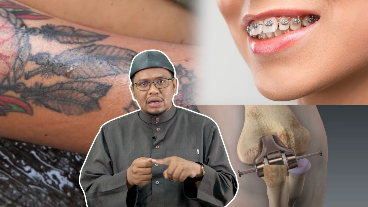 Kena Buang Ke Susuk, Tatu, Braces Jenazah?