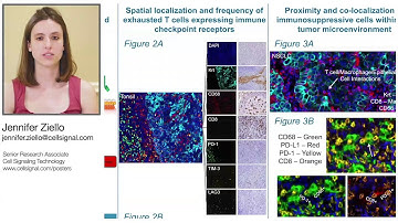 Highly Multiplexed IHC Assays to Examine Immune Checkpoints and Biomarkers for Immunotherapy